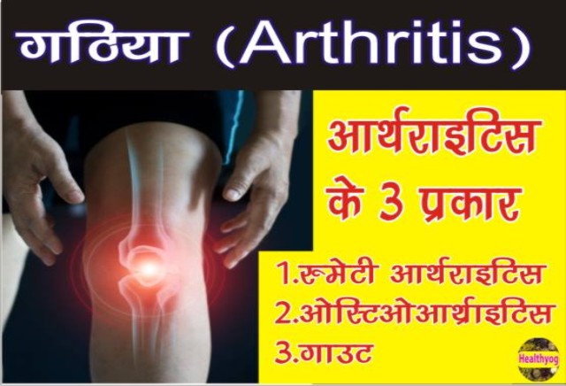 गठिया बाय का रामबाण इलाज