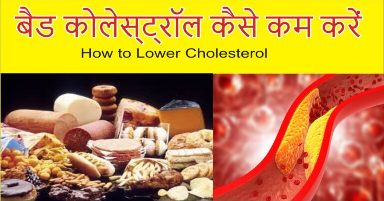 बैड कोलेस्ट्रॉल कैसे कम करें